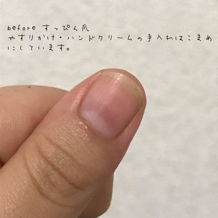 スピーディ トップコートR/シュガードール/ネイルトップコートを使ったクチコミ(2枚目)