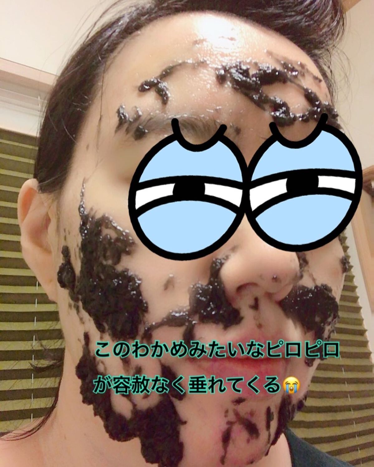 ニードル炭酸パック/NNE/洗い流すパック・マスクを使ったクチコミ(6枚目)