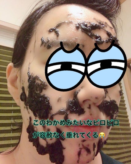 ニードル炭酸パック/NNE/洗い流すパック・マスクを使ったクチコミ(6枚目)