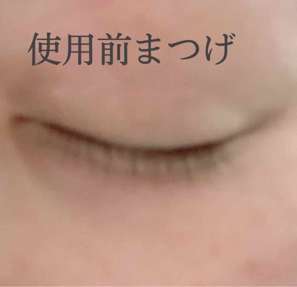 リバイタラッシュ アドバンス ジャパン/エム・アール・アイ/まつげ美容液を使ったクチコミ(2枚目)