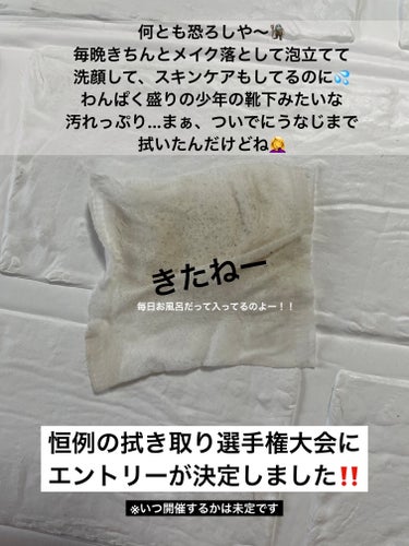 ちふれ ふきとり化粧水のクチコミ「　　　【己の汚さにひたすらショックっす😨】



　　　　　　⚠️２枚目汚れあり⚠️

　　　.....」（2枚目）