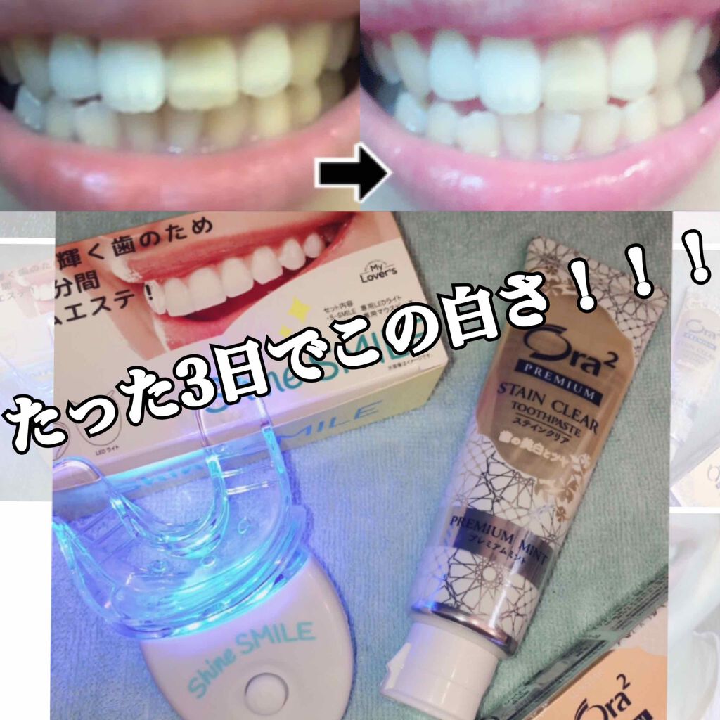 プレミアム クレンジングペースト/オーラツー/歯磨き粉を使ったクチコミ(1枚目)