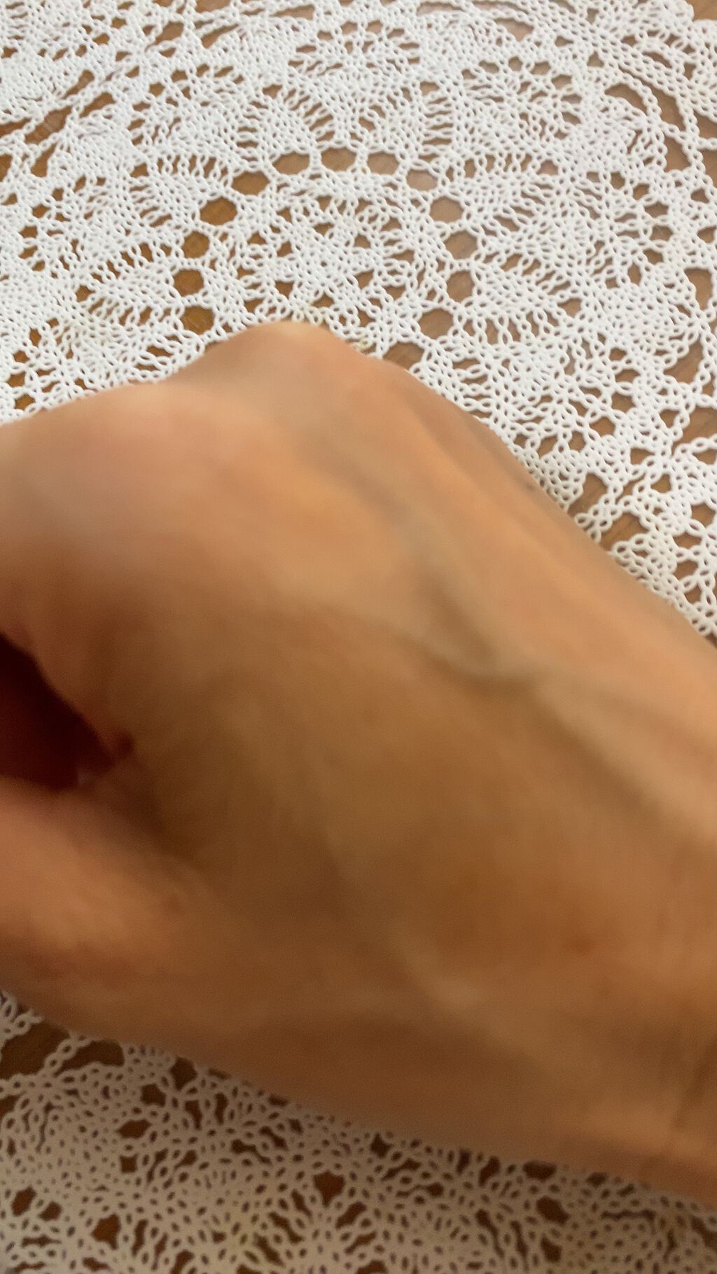 フォーザエフ 薬用 リンクルクリア エッセンス /ナリスアップ/美容液を使ったクチコミ(3枚目)