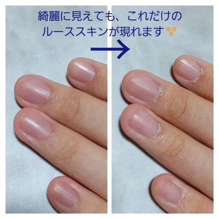 を使ったクチコミ(2枚目)