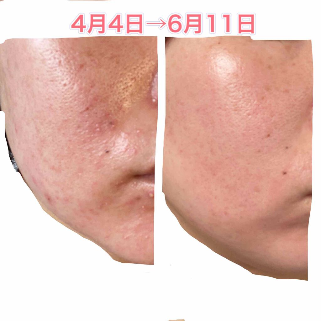 ロゼット洗顔パスタ 海泥スムース/ロゼット/洗顔フォームを使ったクチコミ（2枚目）