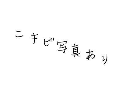 えぐ on LIPS 「⚠︎敏感肌＋脂性肌とてつもなく顎ニキビは増えました(இ﹏இ)昨..」（1枚目）