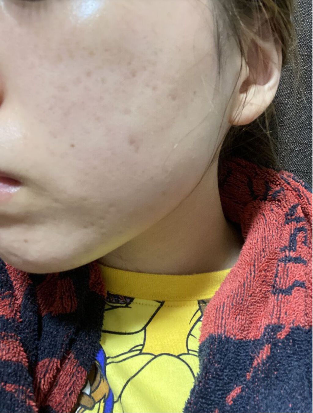 ホワイトニング ミスト セラム/アルージェ/ミスト状化粧水を使ったクチコミ（3枚目）