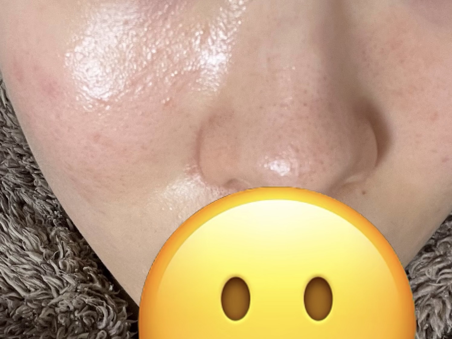 アクネケア 洗顔クリーム ＜医薬部外品＞/ファンケル/洗顔フォームを使ったクチコミ（3枚目）