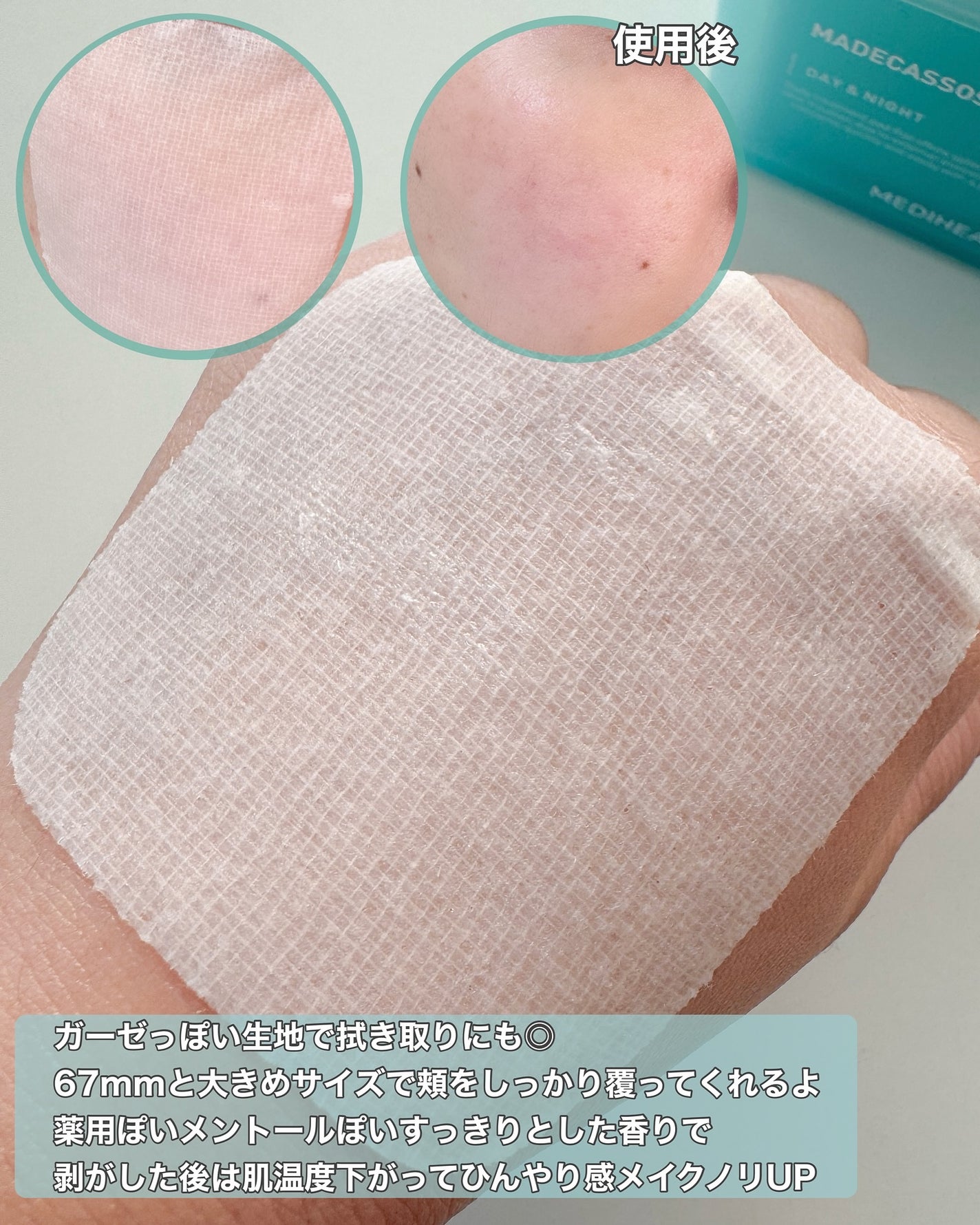 マデカソサイド ブレミッシュパッド/MEDIHEAL/トナーパッドを使ったクチコミ(4枚目)