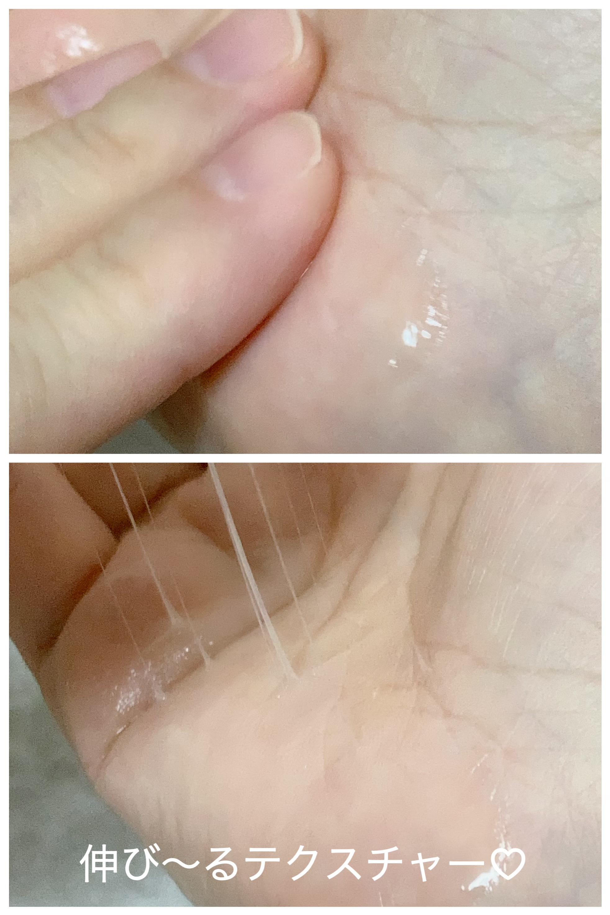 リマージ糸リフティングアンプル/REVENIP/美容液を使ったクチコミ（3枚目）