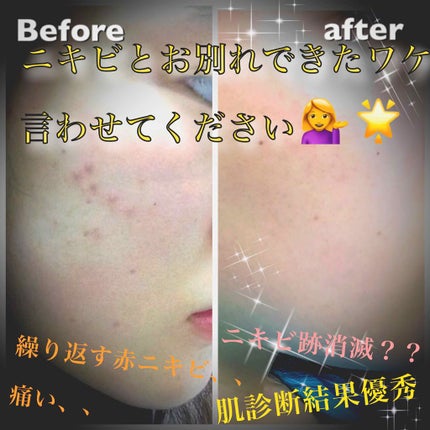 ザ・タイムR アクア/IPSA/化粧水を使ったクチコミ(1枚目)