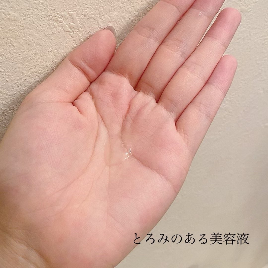 REVERSAL DROP/fonskin/美容液を使ったクチコミ(5枚目)