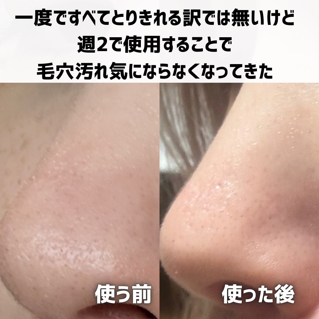 ナチュラルマイルドクリアノーズパック/ilso/シートマスク・パックを使ったクチコミ(5枚目)