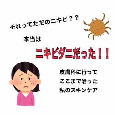 ❗️肌の汚い画像アリ苦手な人は気をつけて❗️

こんにちは！
incです！
今日は私がニキビに悩んでた時のお話をします。

高校3年生の私はずっとニキビに悩んでいました。出来ては消えて出来ては消えてで、