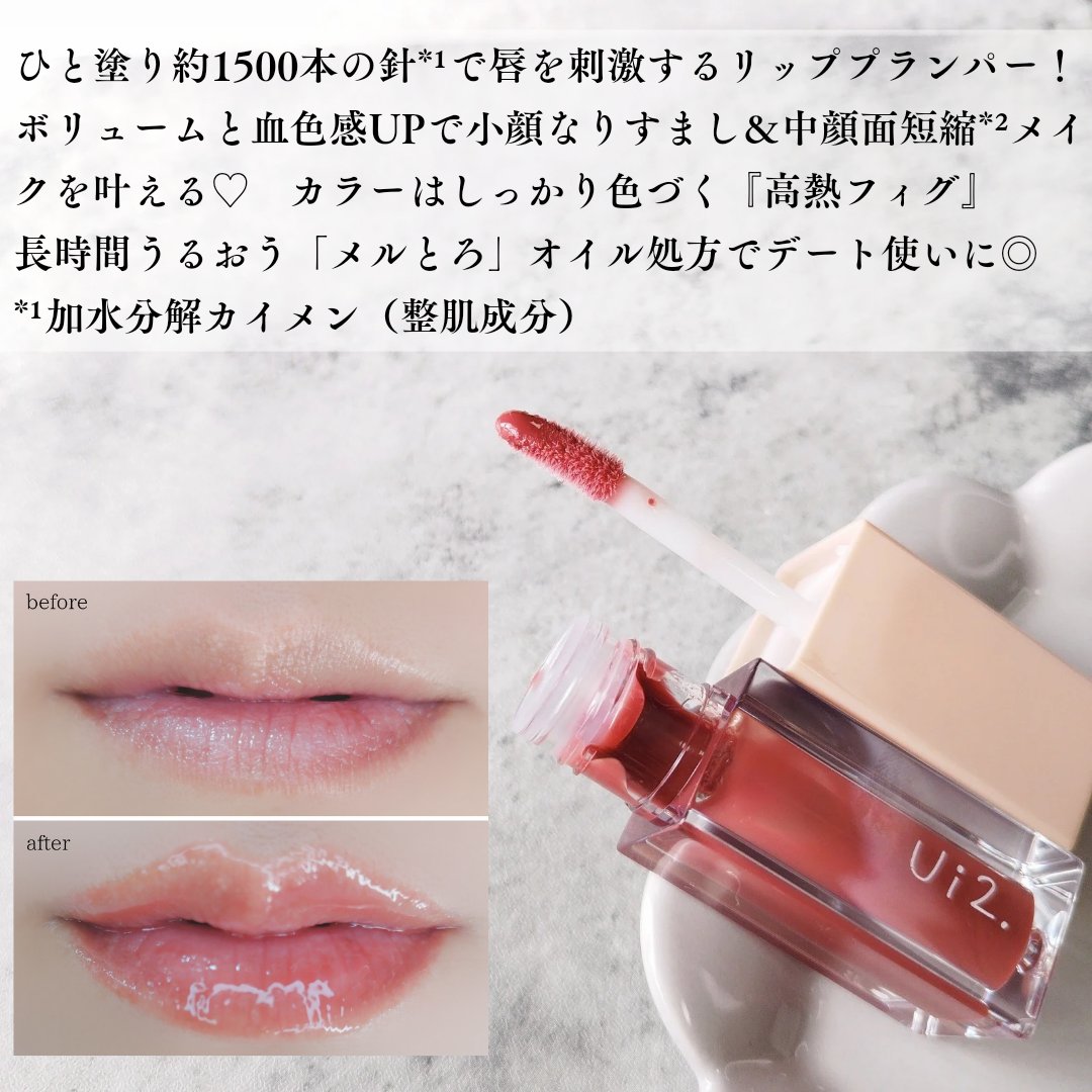 ニードルプランパー 高熱フィグ/Ui2./リッププランパーを使ったクチコミ（2枚目）