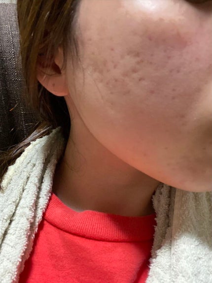 ブライト&バウンシングローション(ノーマルタイプ)/ジュレリッチ/化粧水を使ったクチコミ(1枚目)