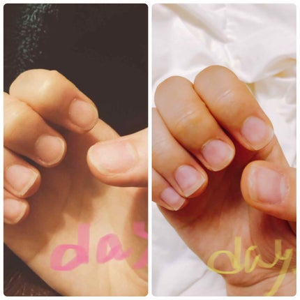 ネイルトリートメント N/ネイルネイル/ネイルオイル・トリートメントを使ったクチコミ(3枚目)