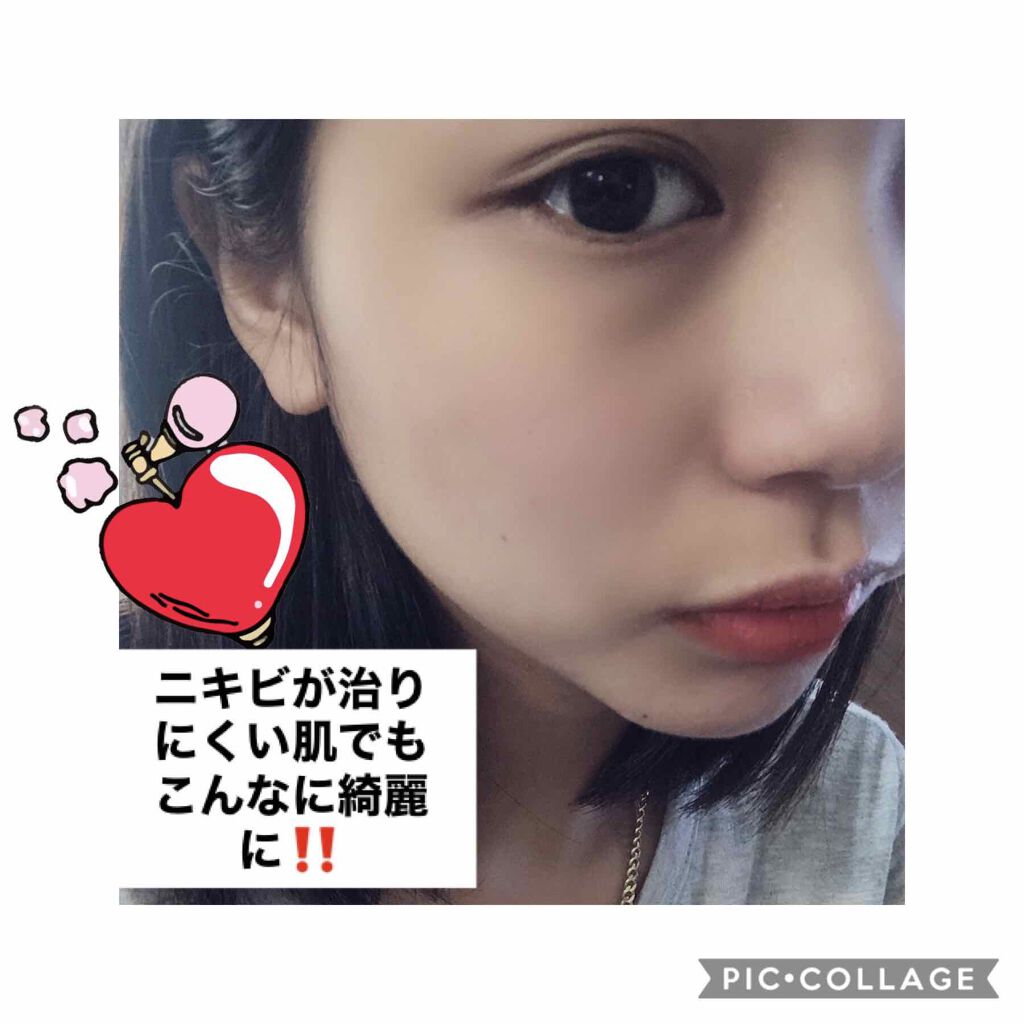 ルルルンピュア 白(クリア)/ルルルン/シートマスク・パックを使ったクチコミ(1枚目)