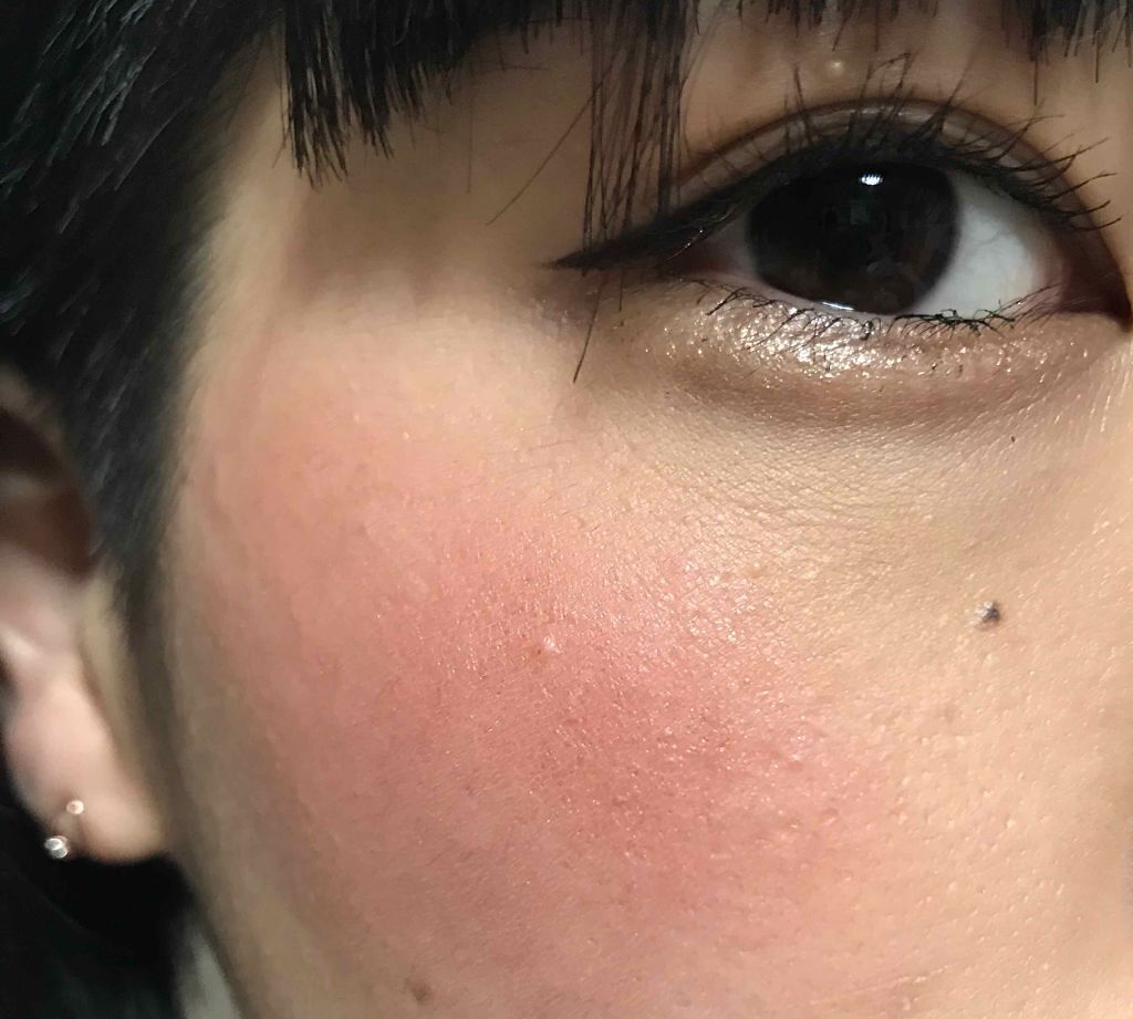 リシェ フォギーオン チークス/Visée/パウダーチークを使ったクチコミ（2枚目）