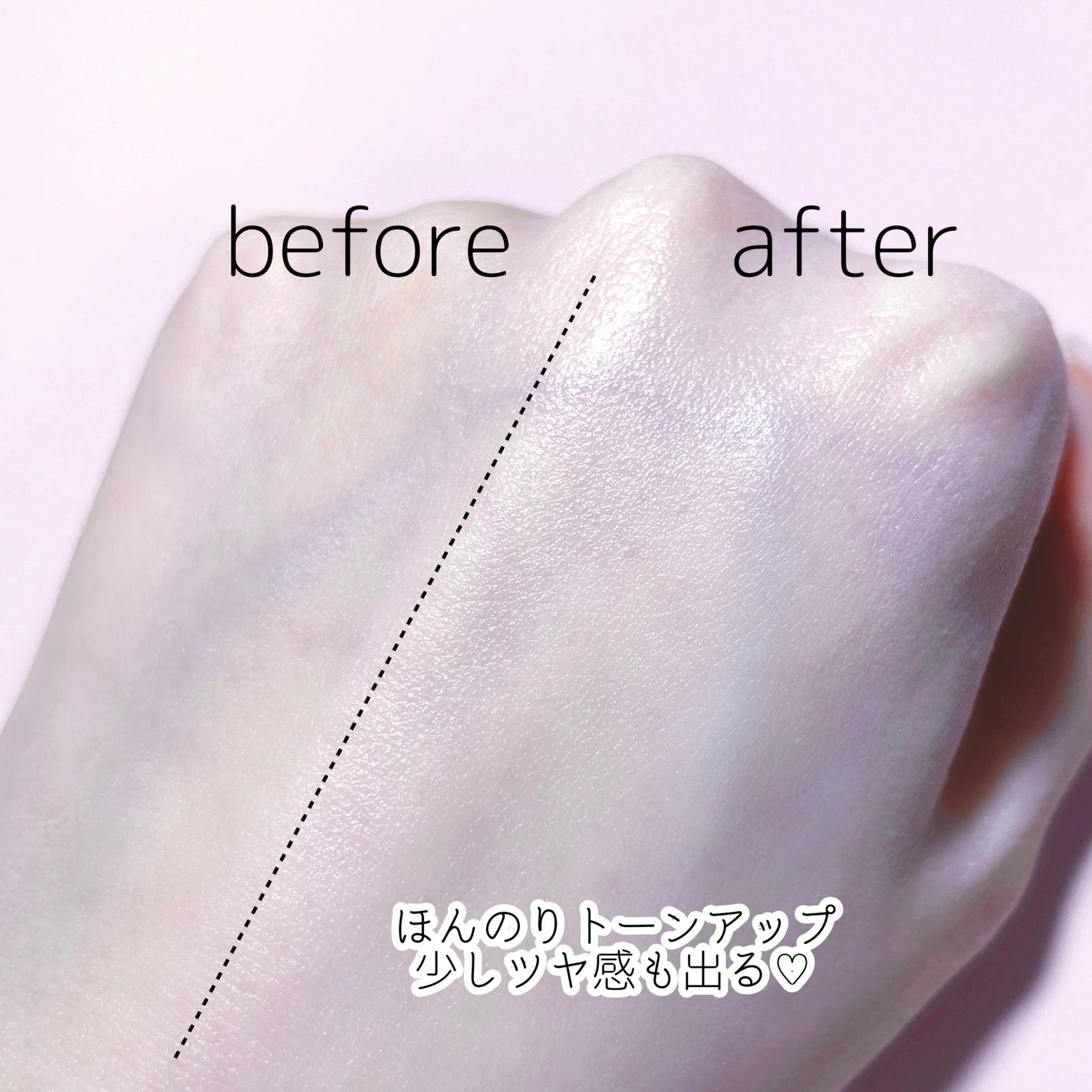 ナイアシンアミド10%カラミンクリーム/DERMA FACTORY/フェイスクリームを使ったクチコミ(4枚目)