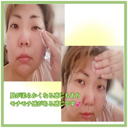 ドクダミカーミングタッチスポットパッド/Abib /トナーパッドを使ったクチコミ(3枚目)