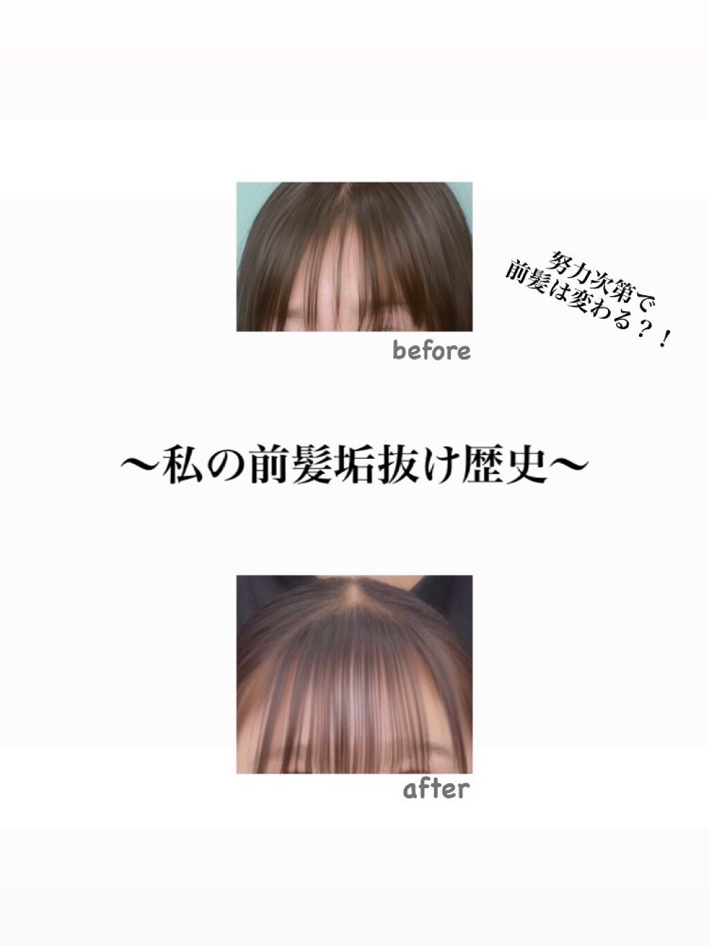 のあ on LIPS 「初投稿は私の前髪の垢抜け歴史です!これを見てくださってる方々に..」(1枚目)