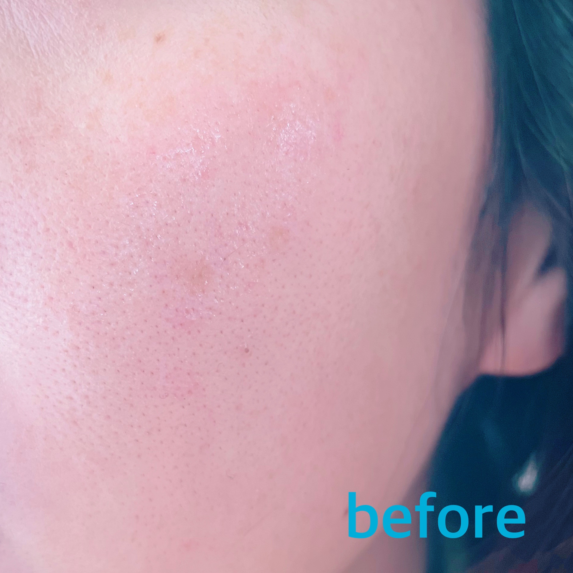 ピンクティーツリーカバープライマークッション/APLIN/クッションファンデーションを使ったクチコミ（3枚目）