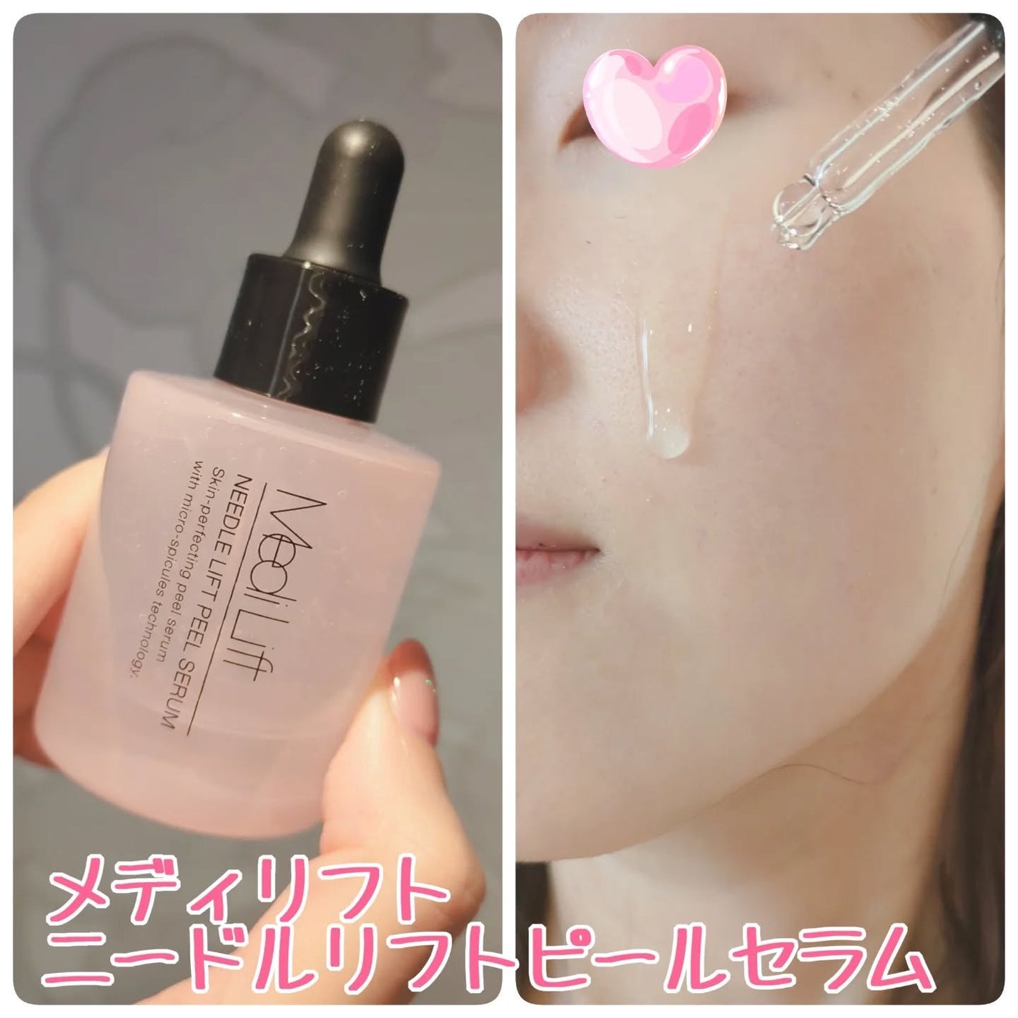 メディリフト ニードルリフトピールセラム/YA-MAN TOKYO JAPAN/美容液を使ったクチコミ(2枚目)