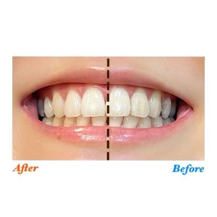 ミュゼホワイトニング 速攻美白 ポリリンキューブ 3個入り/ミュゼホワイトニング/歯磨き粉を使ったクチコミ(5枚目)