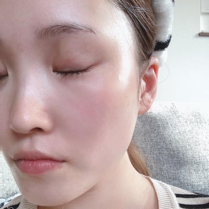 アドバンスバリア セラム (敏感肌用美容液)/iniks/美容液を使ったクチコミ(4枚目)