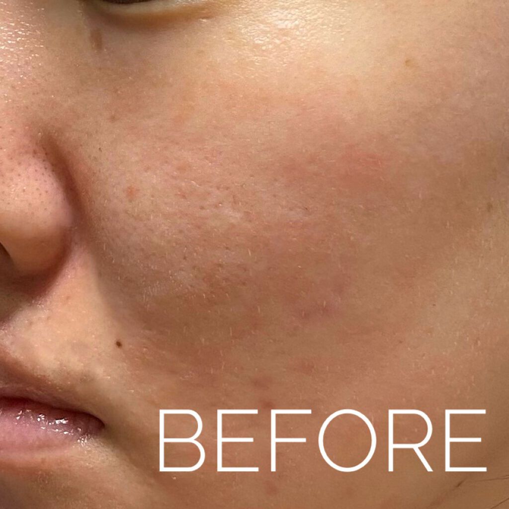 エクサージュホワイト ホワイトライズ ミルク/ALBION/乳液を使ったクチコミ(2枚目)