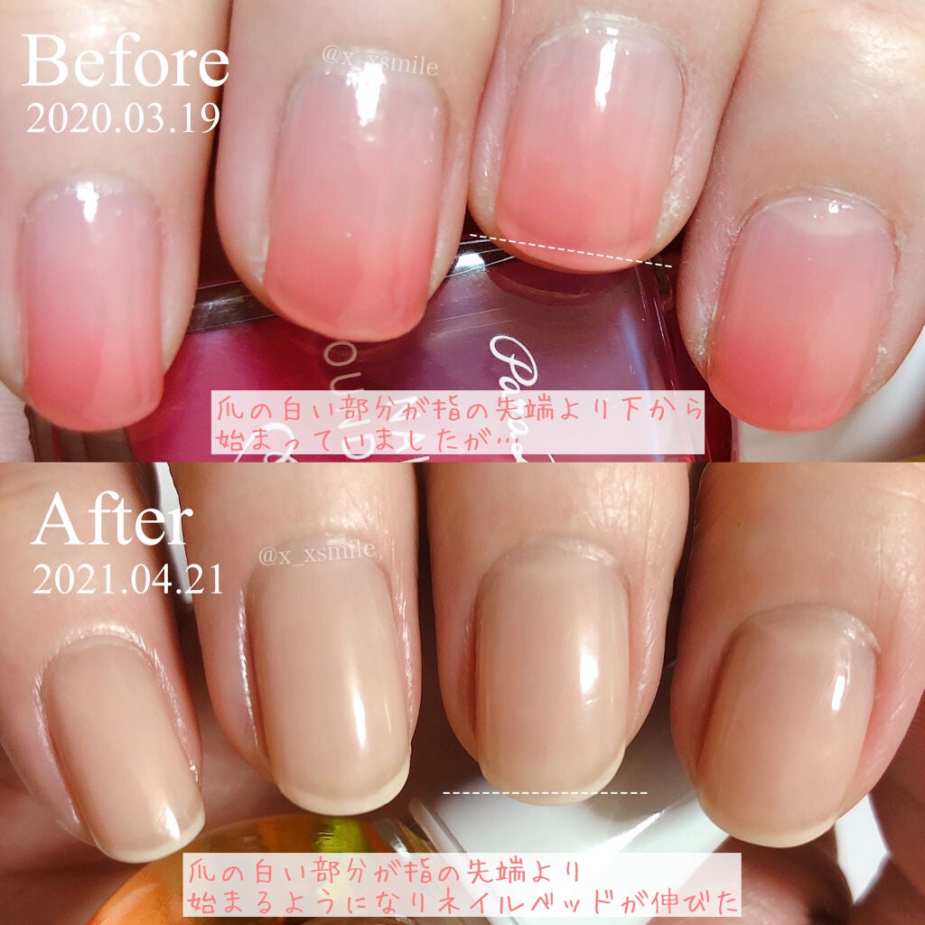 キューティクルオイルⅡ/デュカート/ネイルオイル・トリートメントを使ったクチコミ(6枚目)