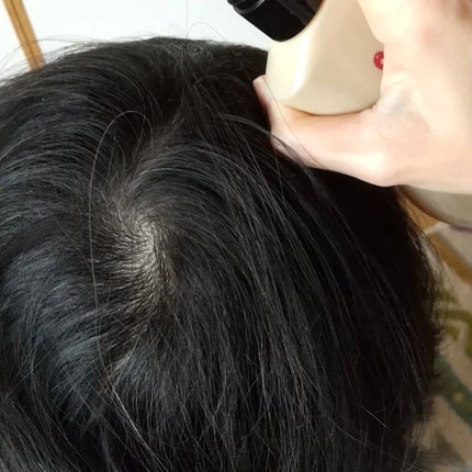 ふわ姫<医薬部外品>/ソーシャルテック/頭皮ローションを使ったクチコミ(4枚目)