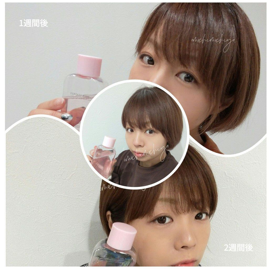 ピンクティーツリートナー/APLIN/化粧水を使ったクチコミ（2枚目）