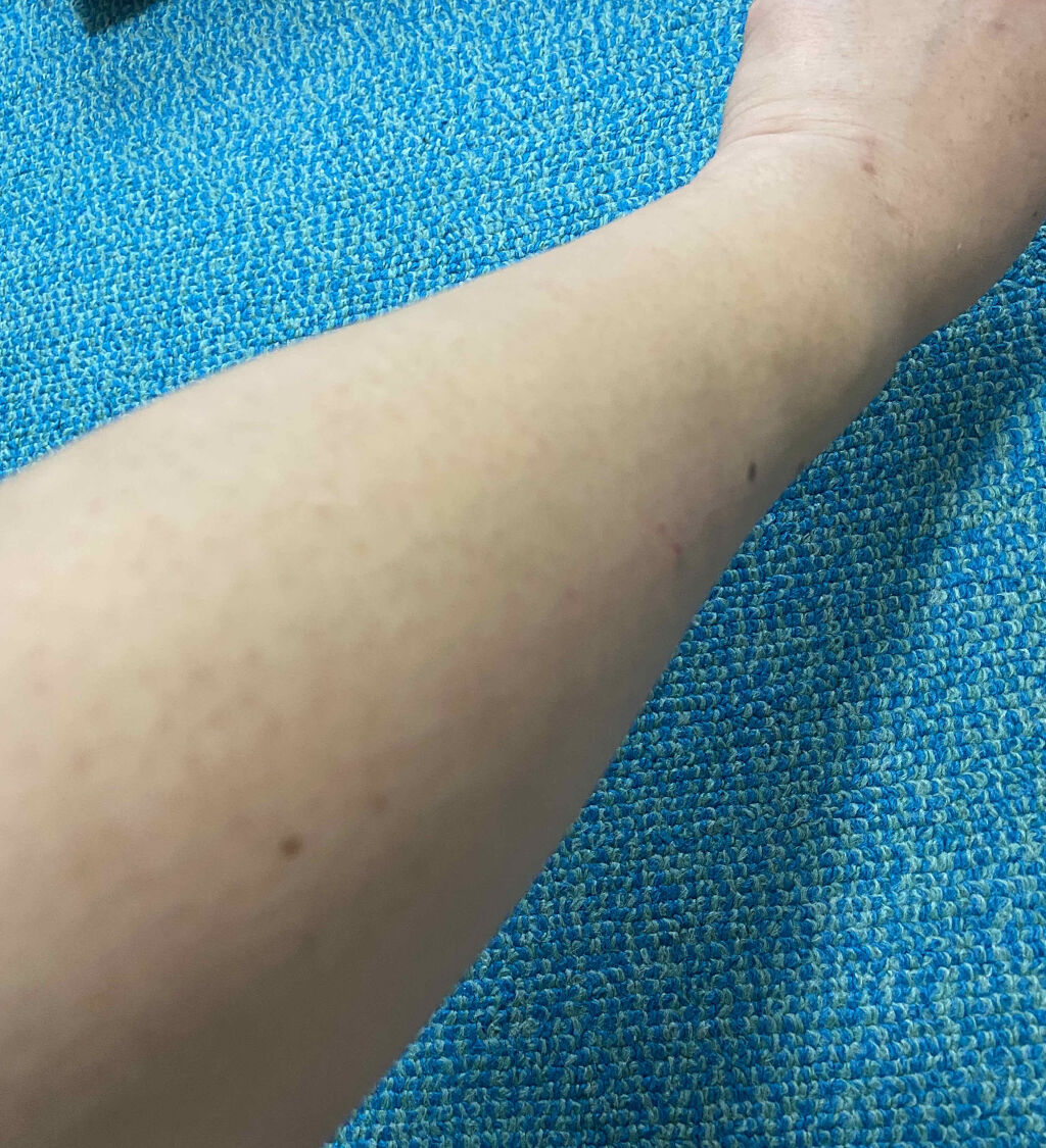 ゼロクリーン　パイナップル&豆乳ローション/美健コーポレーション/ボディローションを使ったクチコミ（3枚目）