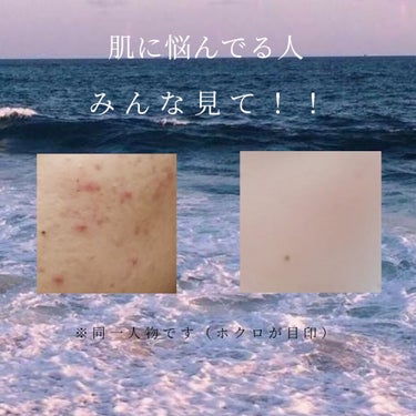 ハトムギ化粧水(ナチュリエ スキンコンディショナー R )/ナチュリエ/化粧水を使ったクチコミ（1枚目）