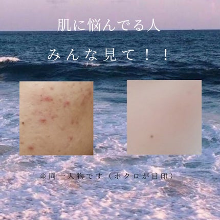 ハトムギ化粧水(ナチュリエ スキンコンディショナー R )/ナチュリエ/化粧水を使ったクチコミ(1枚目)