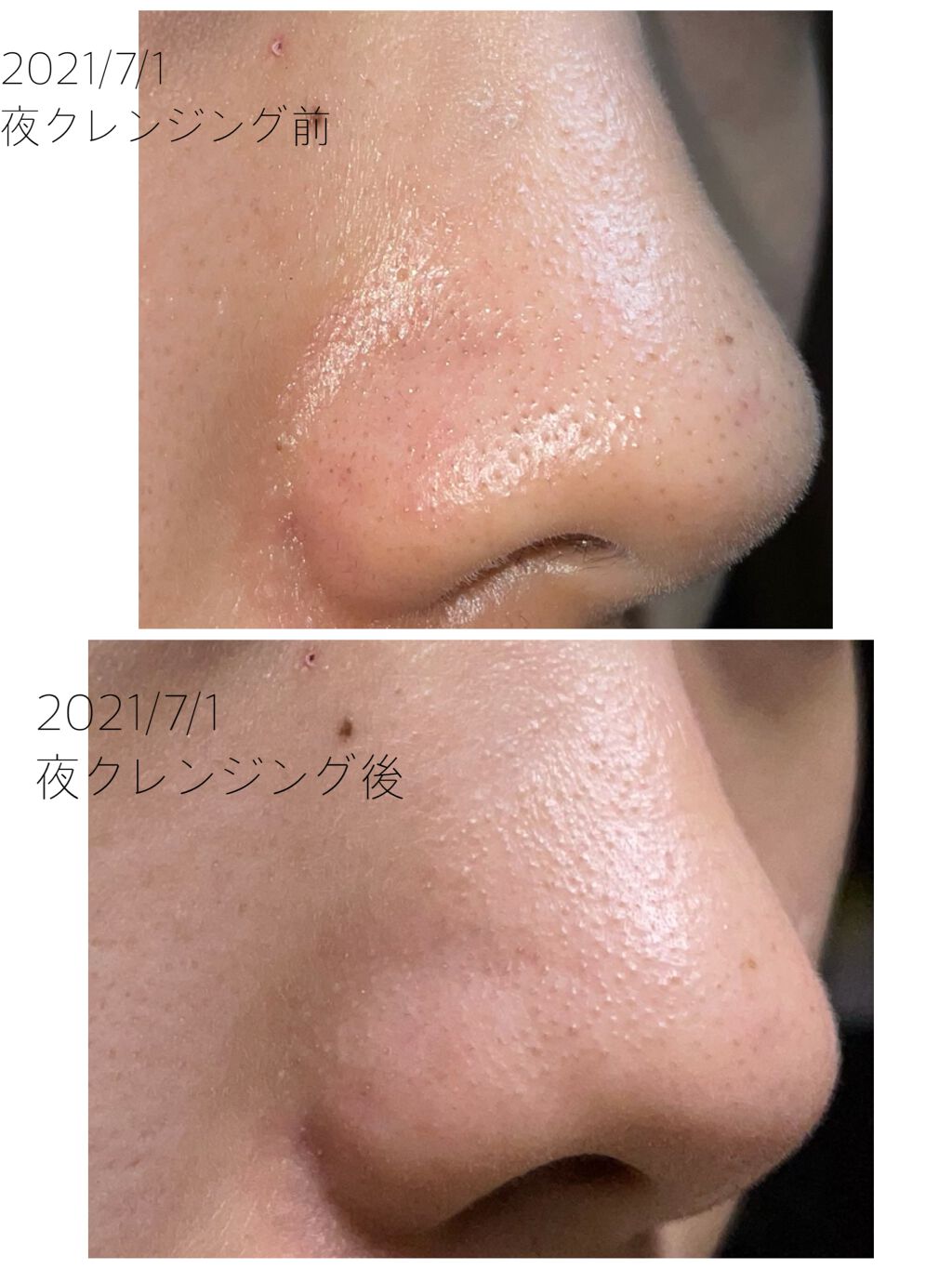 THREE バランシング クレンジング オイルジェル/THREE/クレンジングジェルを使ったクチコミ(6枚目)