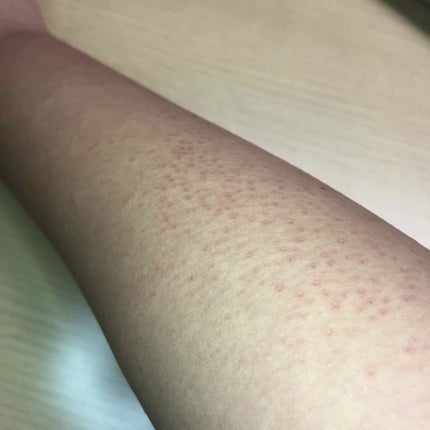 バスタイム除毛クリーム 敏感肌用/Veet/除毛クリームを使ったクチコミ(2枚目)