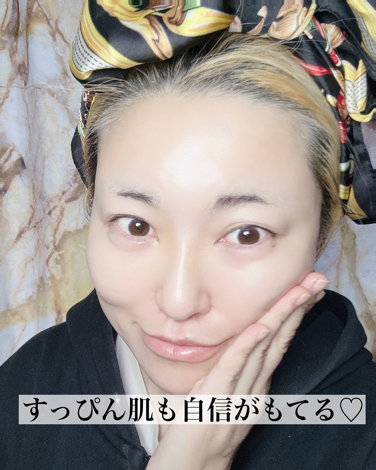 PDRNヒアルロン酸カプセル100セラム/Anua/美容液を使ったクチコミ(4枚目)