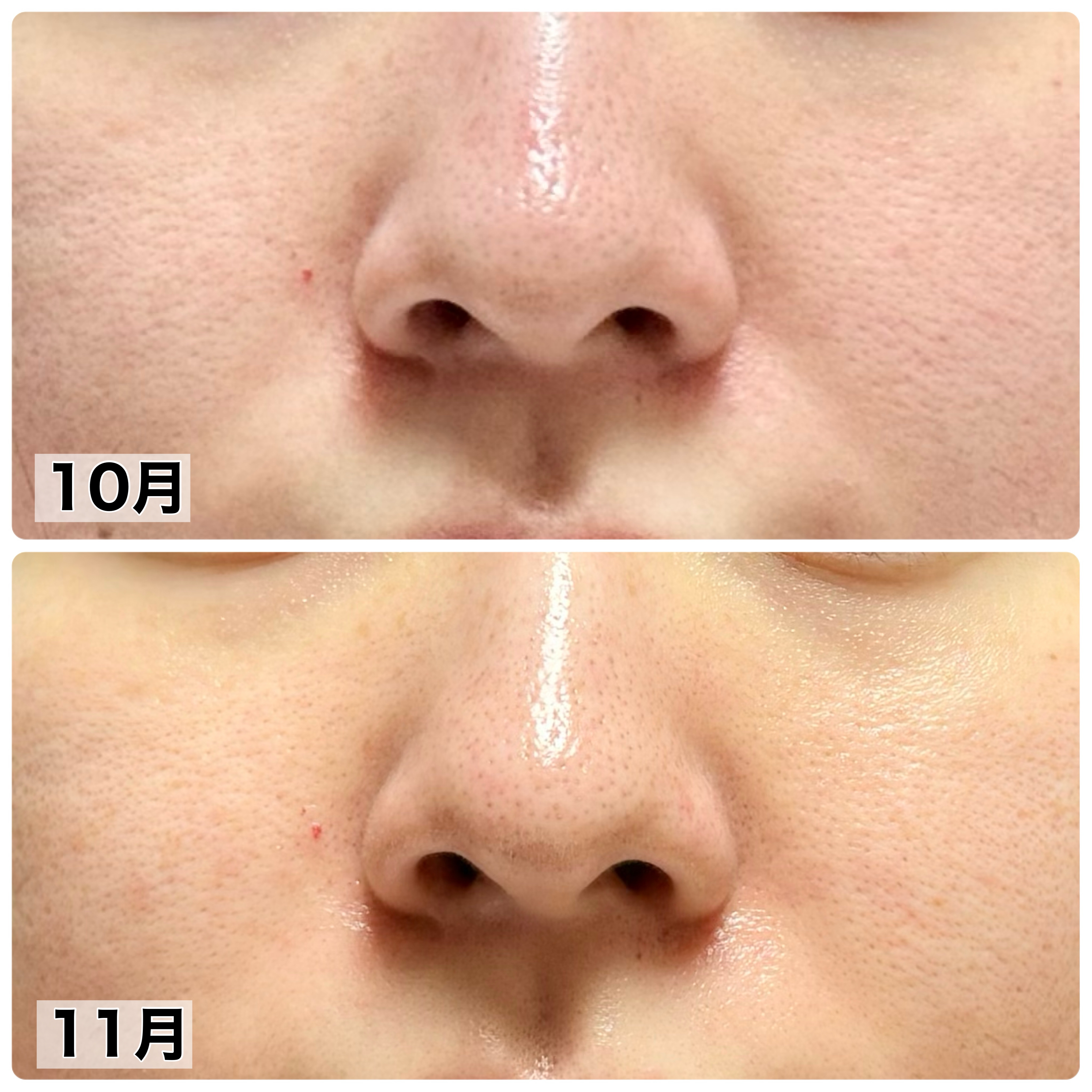 浸透発酵レチノールエッセンスセラム/NARTH/美容液を使ったクチコミ（2枚目）