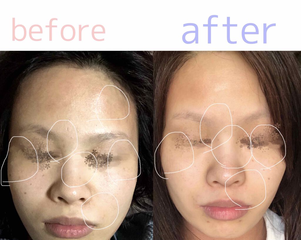 メラノショット ホワイト D/ONE BY KOSE/美容液を使ったクチコミ(2枚目)