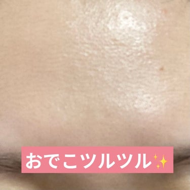 AHA 30% + BHA 2% Peeling Solution/The Ordinary/ピーリングを使ったクチコミ（2枚目）