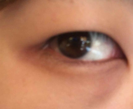 ギー汰 on LIPS 「最初に、朝から酷い画像見せてしまってすいません。目尻の赤茶にっ..」(1枚目)