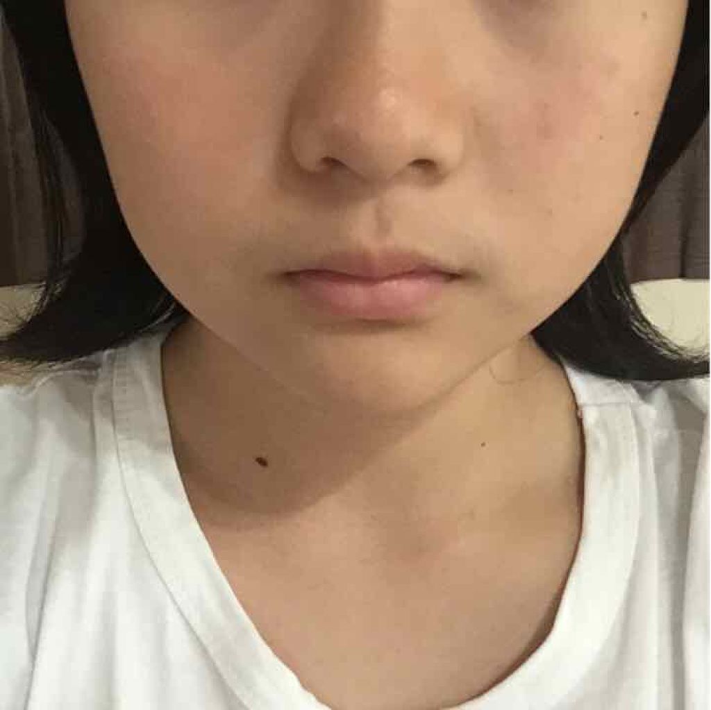 ここタピ on LIPS 「まじで白くなるファンデ・くすみ・赤み・くまなどなどこんなに汚い..」(1枚目)