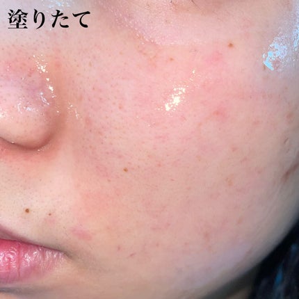 ももぷり フレッシュピールオフパック/ももぷり/ピーリングを使ったクチコミ(4枚目)