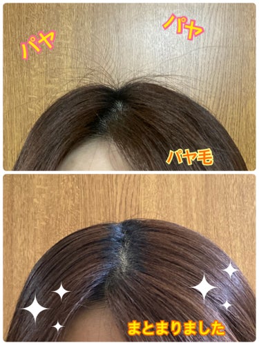 3COINS AUS ヘアスタイリングブラシのクチコミ「#3COINS
#AUSヘアスタイリングブラシ
330円

私は定期的に円形脱毛が起こります
.....」（2枚目）