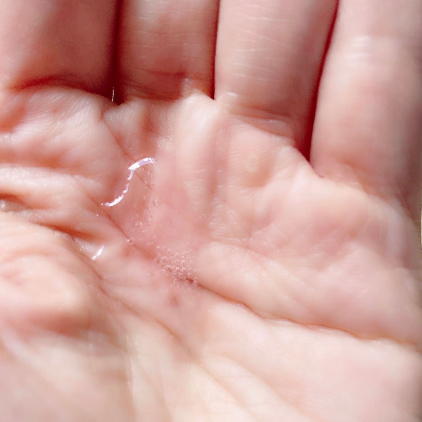 センシティブ ベースケアコンク/Asmy/美容液を使ったクチコミ(5枚目)