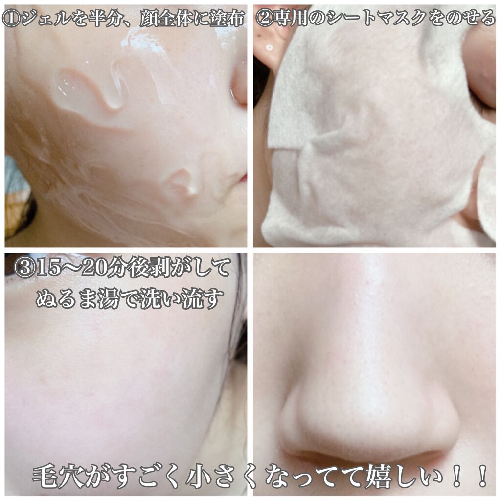 リフトブライトCO2パック/yourline/シートマスク・パックを使ったクチコミ(3枚目)