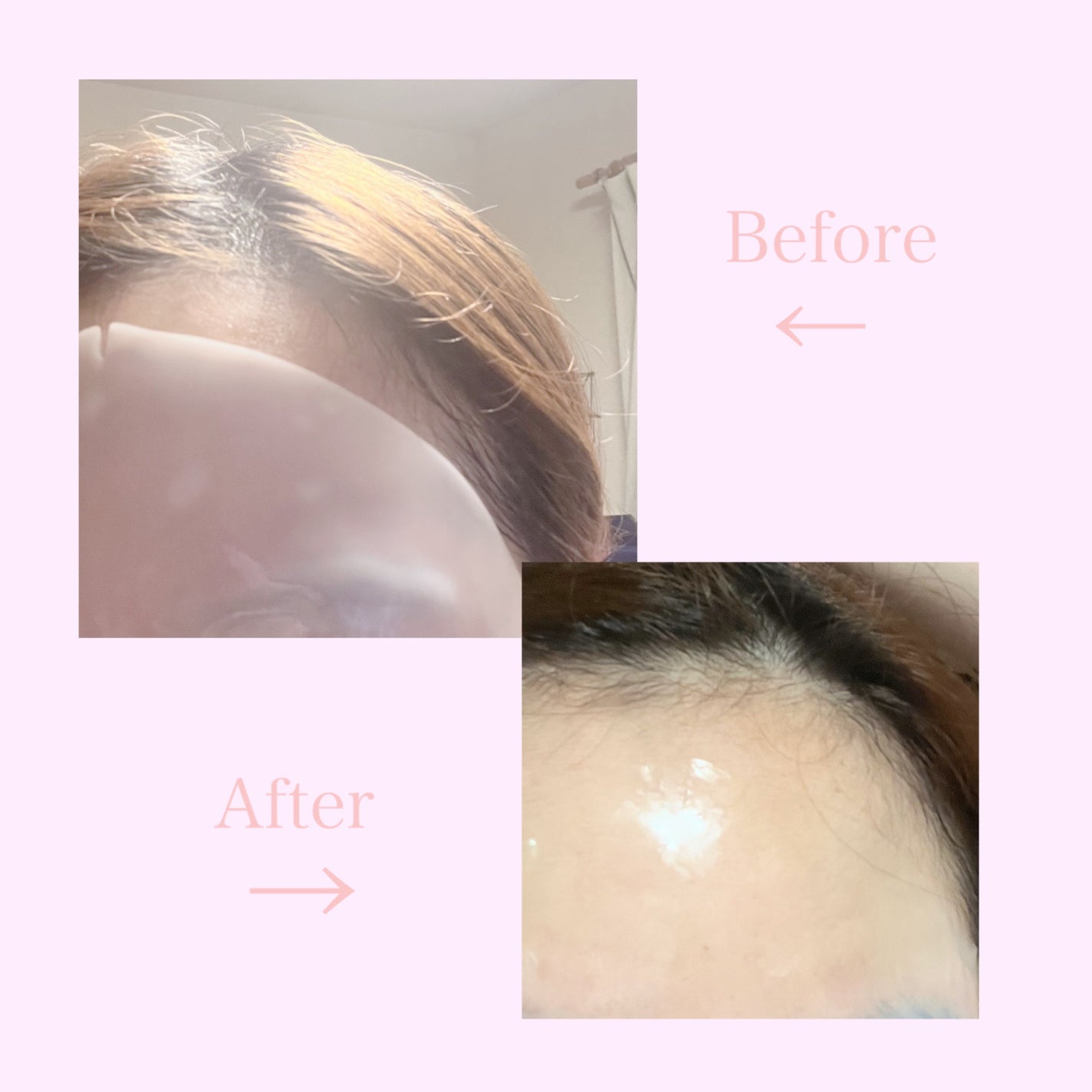 ハイドロセラノールリアルディープマスク/Biodance/シートマスク・パックを使ったクチコミ(2枚目)